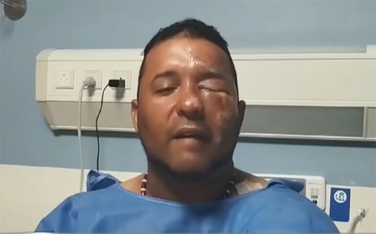 Joan Blowers – LosMocanos