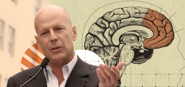 ¿Qué es la demencia frontotemporal?