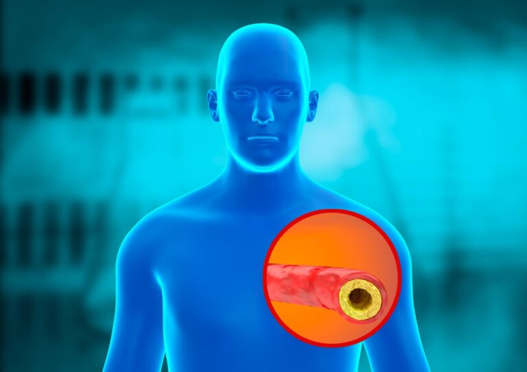 8 señales de que tus niveles de colesterol están altos