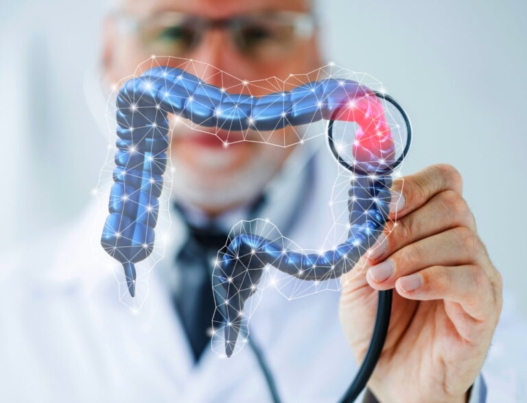 5 factores de riesgo para desarrollar cáncer de colon antes de los 50 años