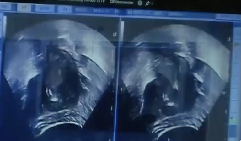 RD con nuevos equipos para tratar cáncer – Remolacha   #FVDigital