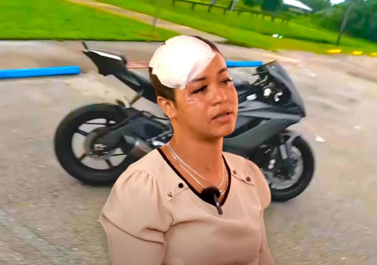 “Se me veía mi cráneo completamente” – #FVDigital