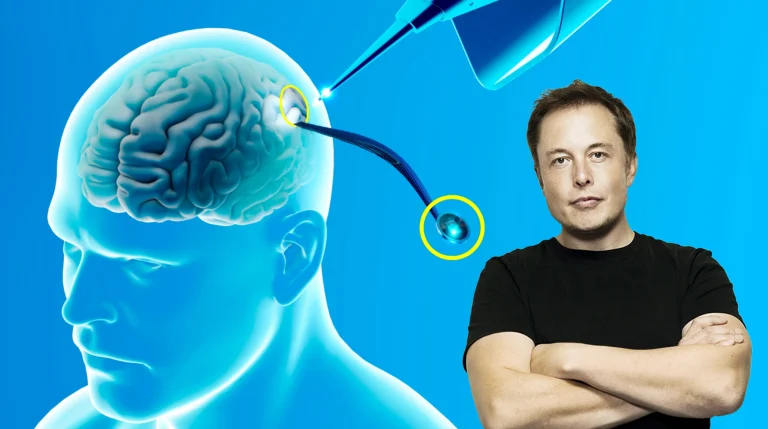 Así funciona el chip cerebral de Elon Musk
