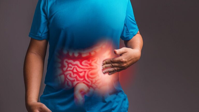 #Salud: Estas cuatro ‘señales de alarma’ del cáncer de intestino que aparecen ‘hasta dos años’ antes del diagnóstico