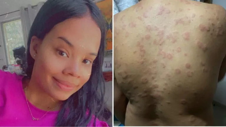 Ayudemos a esta joven dominicana – Remolacha   #FVDigital