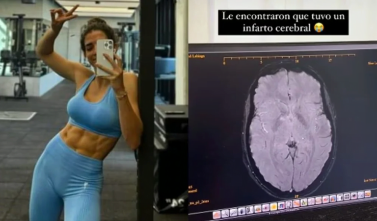 La alarmante experiencia de una influencer fitness al sufrir un infarto cereblar tras inyectarse botox