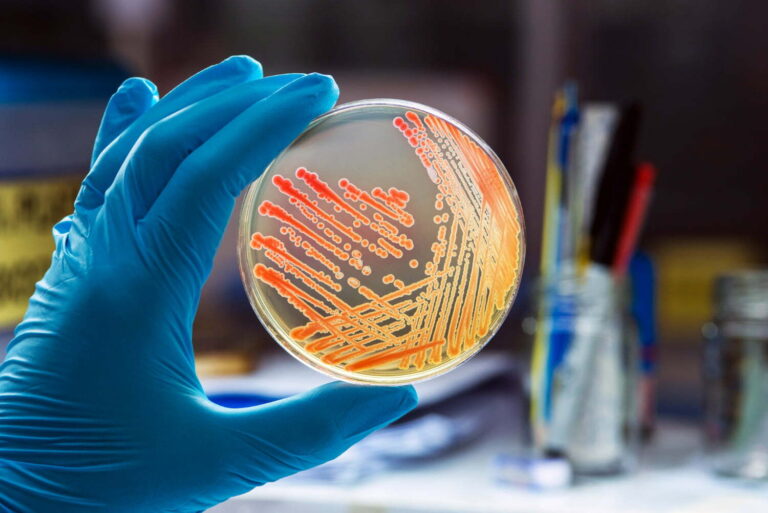 5 ayudas naturales para combatir la bacteria