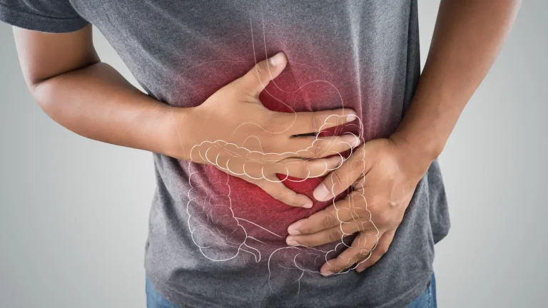 Crece número de personas que padecen cáncer de colon y recto