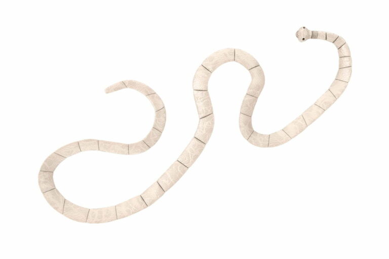 #Salud: Estas son las señales de que puedes tener un parásito intestinal