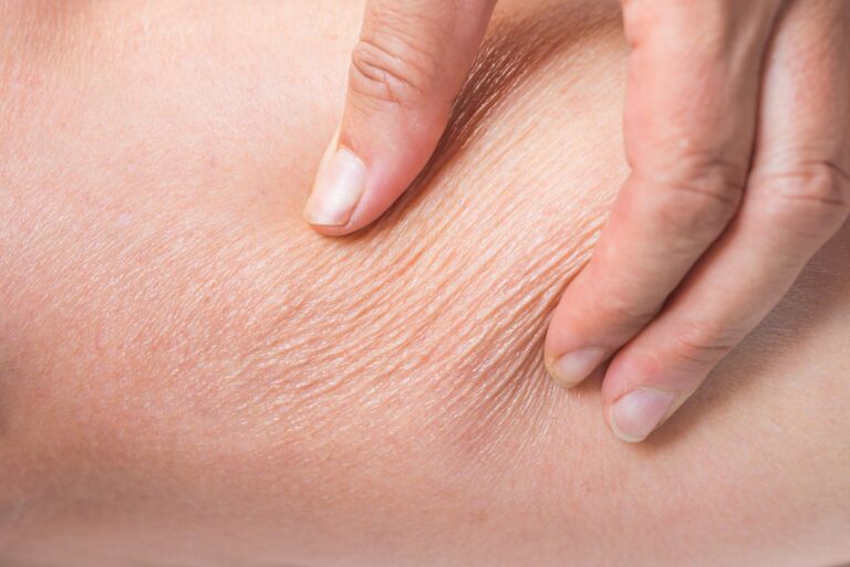 #Salud: cómo hidratar y cuidar tu cutis