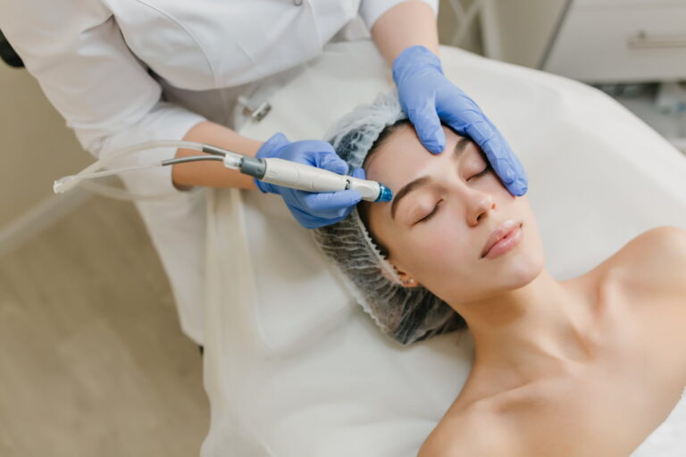 ¿Cómo puede un HydraFacial ayudar a la piel propensa al acné?