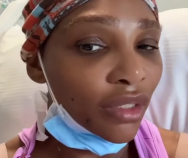Operan con éxito a Serena Williams por quiste en el cuello – Remolacha   #FVDigital