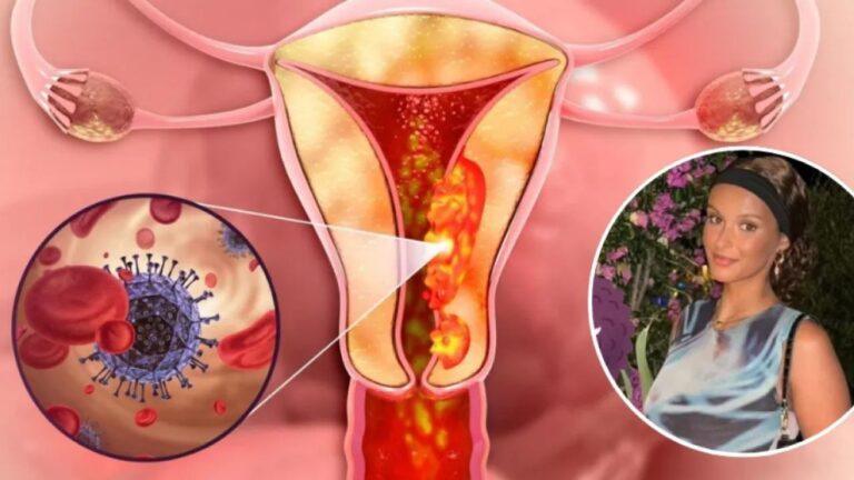 estudiante relata cómo tumor con cabello y dientes cambió su vida