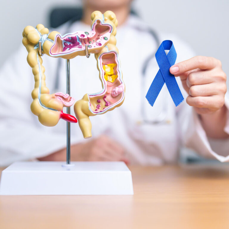 este síntoma estuvo presente en algunos pacientes 90 días antes del diagnóstico