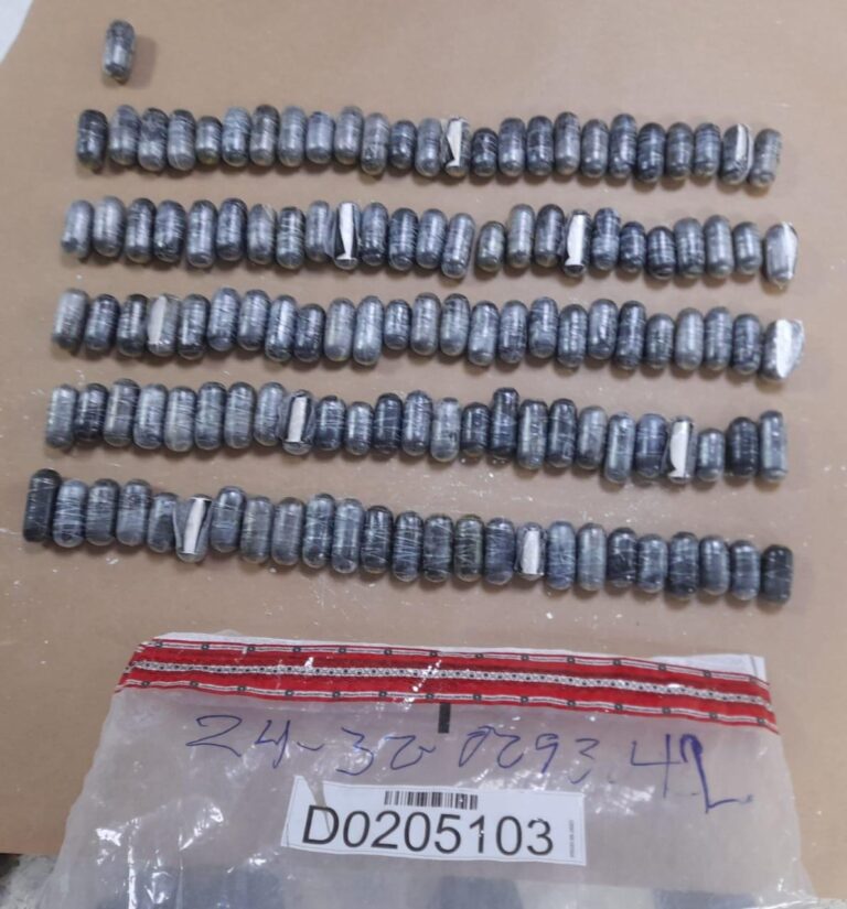 Franceses pretendían viajar con 340 bolsitas de cocaína en el estómago por el AILA