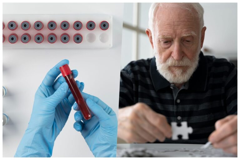 #Salud: Este análisis de sangre tiene una precisión del 90% para detectar el Alzheimer