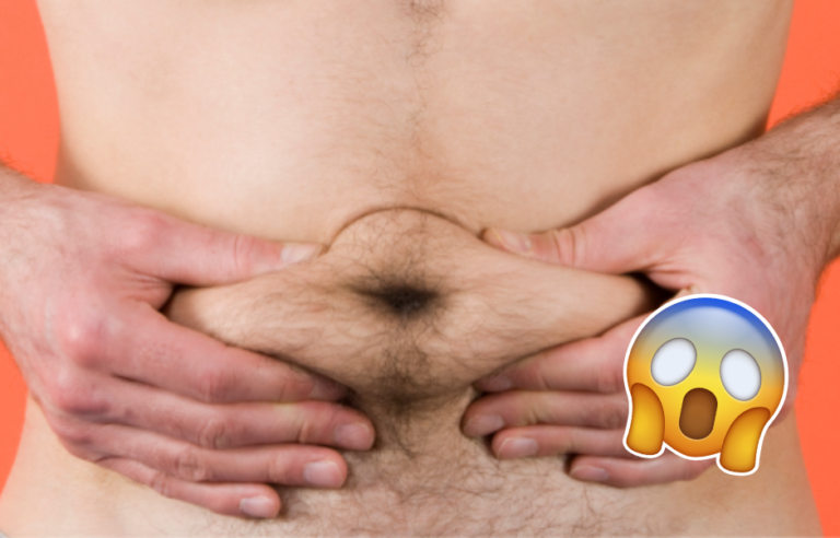 Tipo demanda a su cuñado por sellarle el ombligo con pegamento – #DeInteres   #FVDigital