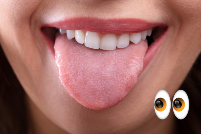 Lo que tu lengua dice sobre tu salud – #DeInteres   #FVDigital