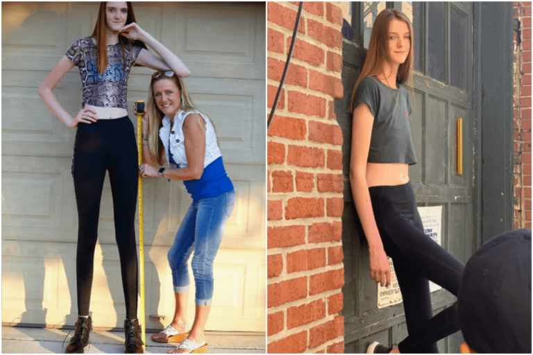 #Salud: La mujer con las piernas más largas del mundo ha revelado los problemas que enfrenta en su vida diaria