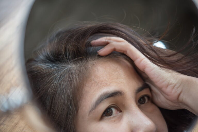 #Salud: ¿Por qué aparecen las canas cuando somos jóvenes?