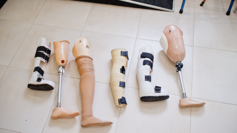 ITLA diseñará prótesis gratuitas a afectados de tragedia en Jet Set – #DeInteres   #FVDigital