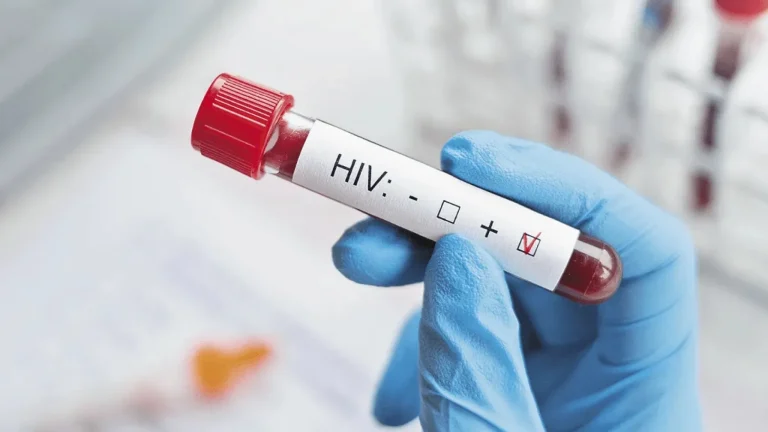 Cerca de 4,000 casos positivos al VIH son reportados por año