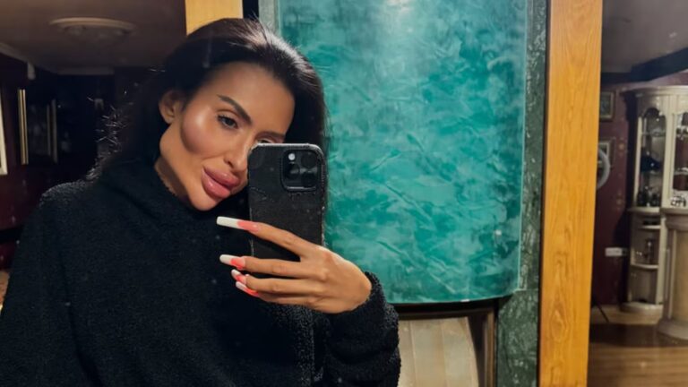 Modelo ucraniana se somete a múltiples procedimientos para tener pómulos más grandes del mundo