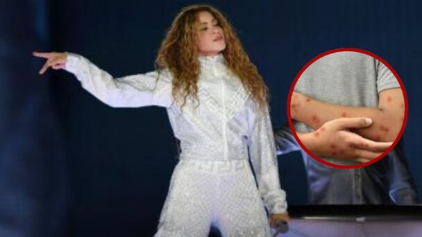 Investigan posible exposición masiva a sarampión en concierto de Shakira en Estados Unidos #FVDigital