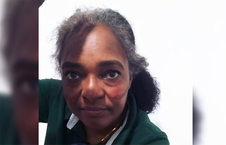 Hombre resulta afectado tras discusión con su pareja en La Javiela #FVDigital