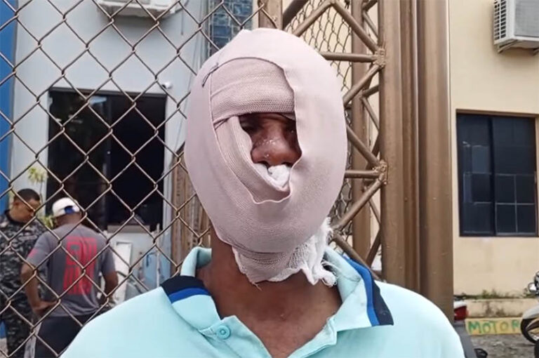 Junior Manuel Tapia – #FVDigital.com