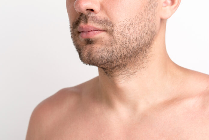 Alopecia-en-la-barba-que-soluciones-esteticas-existen1.jpg