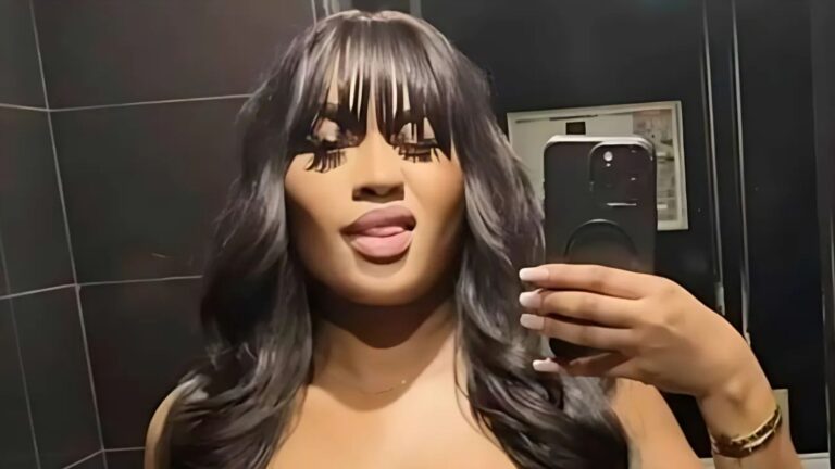 Muere modelo tras someterse a cirugía de levantamiento de glúteos