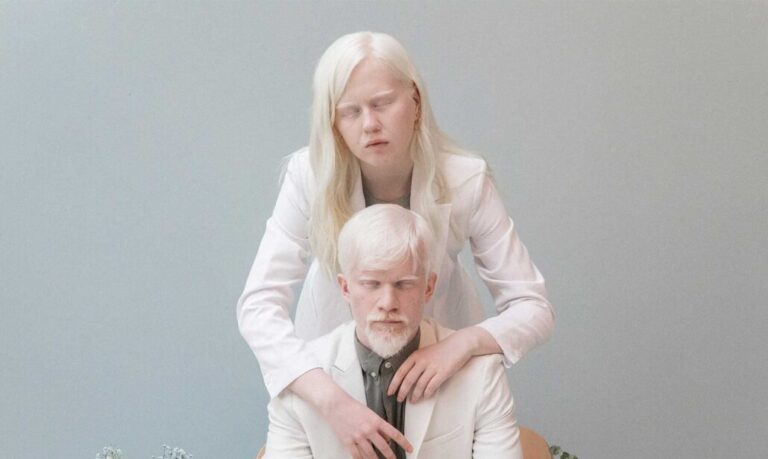 13 de junio: Día Internacional de Sensibilización sobre el Albinismo #FVDigital