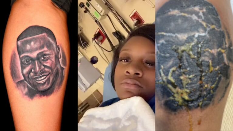 Se hizo un tatuaje en memoria de su hermano y casi le cuesta la vida