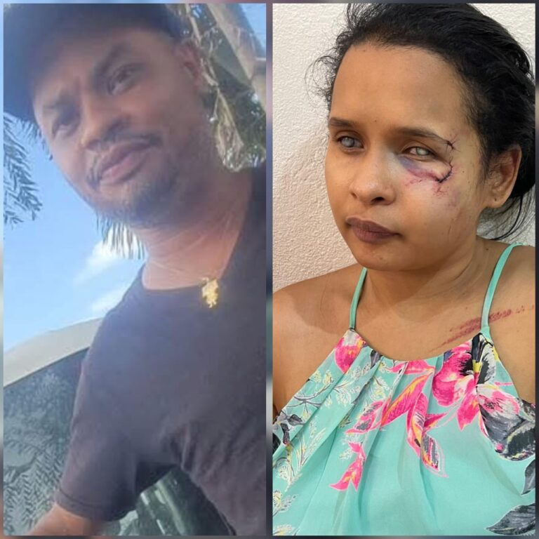 Mujer denuncia agresión por parte de su expareja en Monseñor Nouel #FVDigital