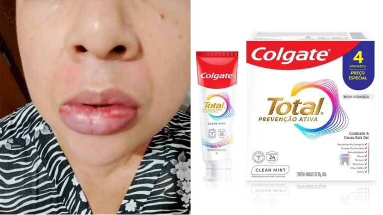 Autoridades reiteran alerta sanitaria sobre pasta dental Colgate Total Clean Mint