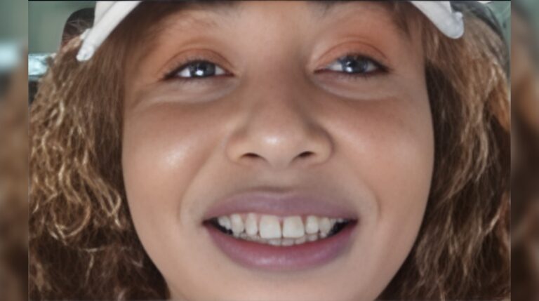 Director de la PN dice que mujer no denunció a su verdugo para no dar escándalo #FVDigital #FelixVictorino