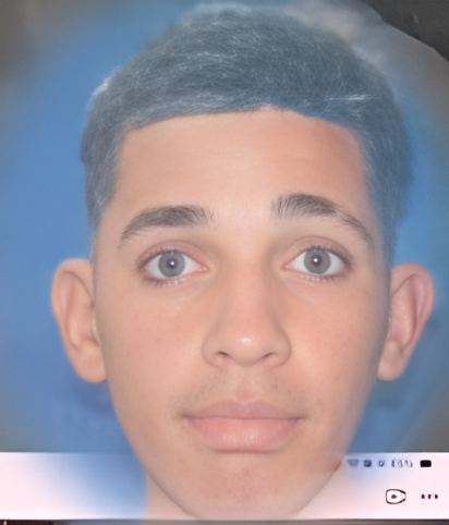 Joven de 22 años hospitalizado tras suceso vial en Nagua