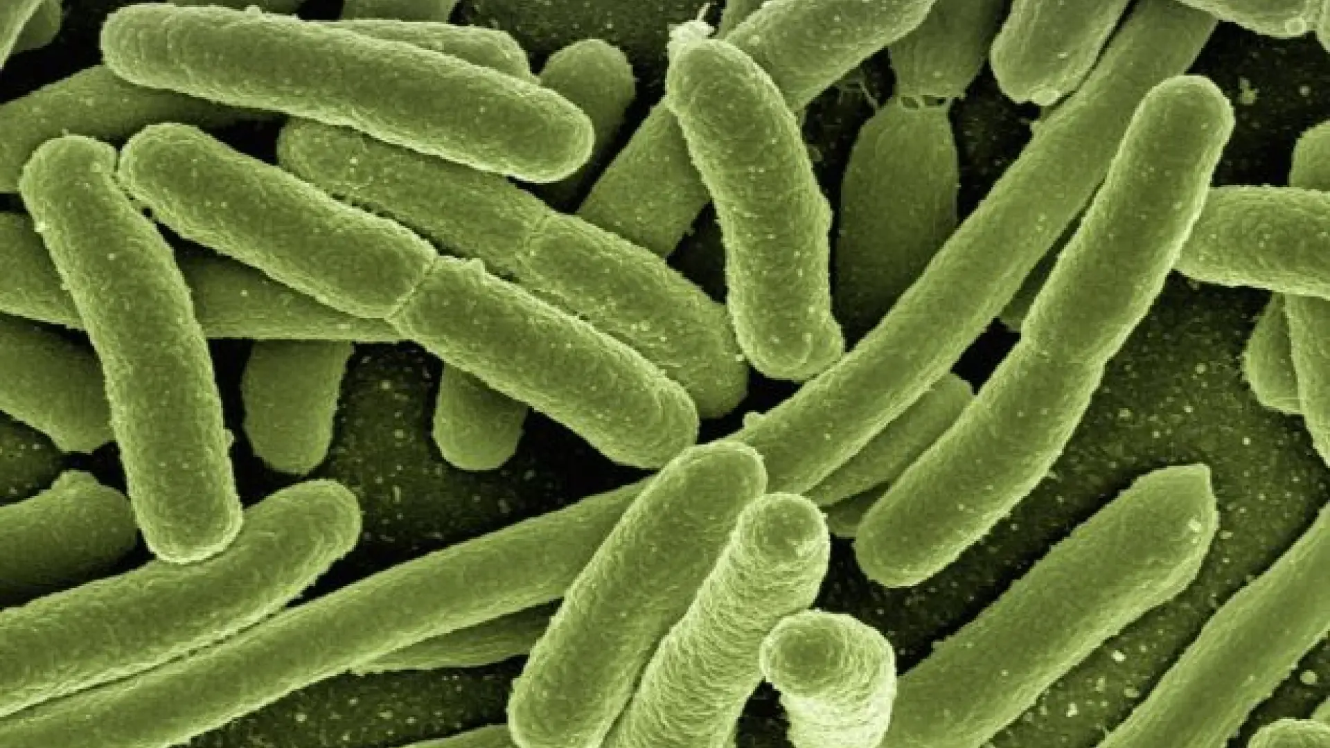 koli-bacteria-123081-1280-620x448.jpeg