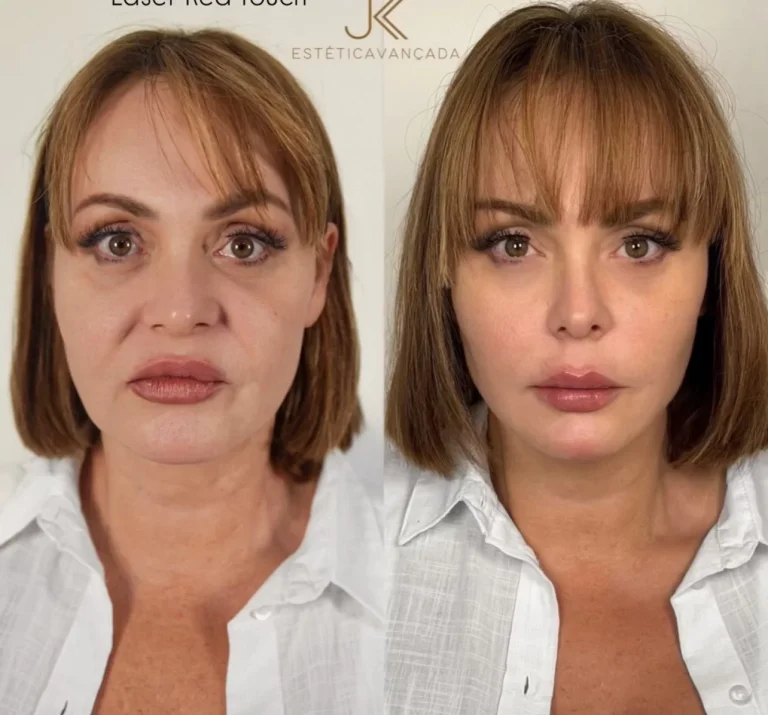 Gaby Spanic reaparece con un rostro totalmente renovado