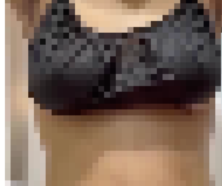 La cirugía plástica pública en RD vive un crecimiento sin precedentes – #DeInteres   #FVDigital