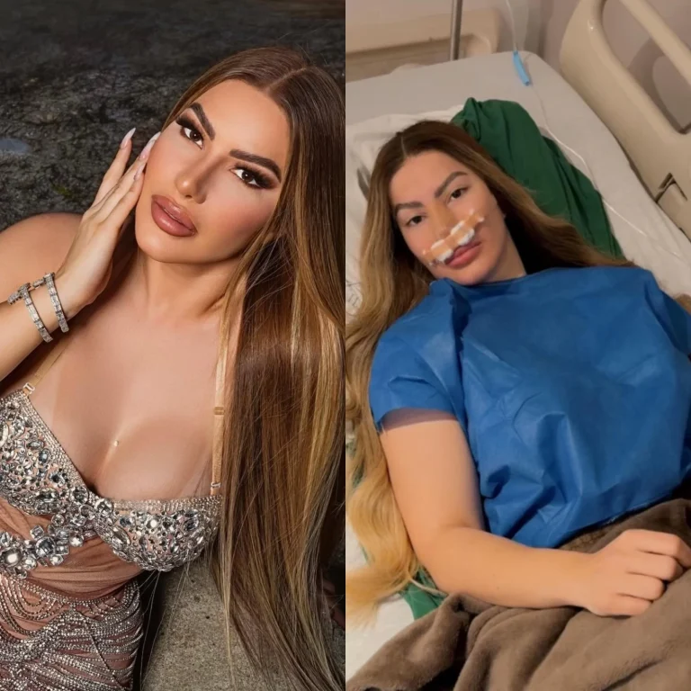 Influencer Alexandra MVP se somete a cirugía plástica y solicita deseos de recuperación