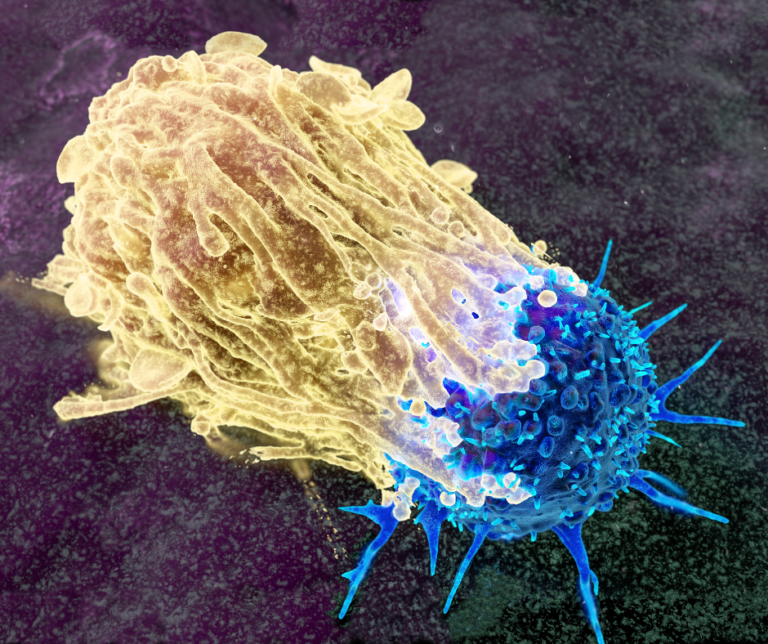 Cáncer de próstata lidera incidencia en República Dominicana – #DeInteres   #FVDigital