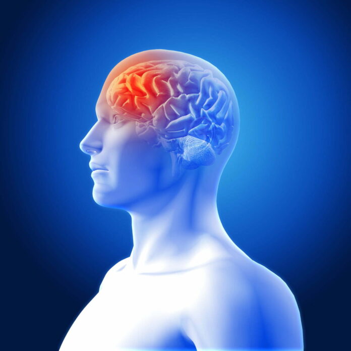 Derrame-cerebral-sintomas-Freepik.jpg
