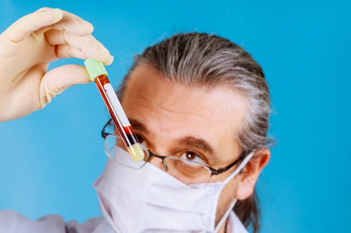 El-revolucionario-analisis-de-sangre-que-esta-cambiando-la-forma-de-detectar-el-Alzheimer.jpg
